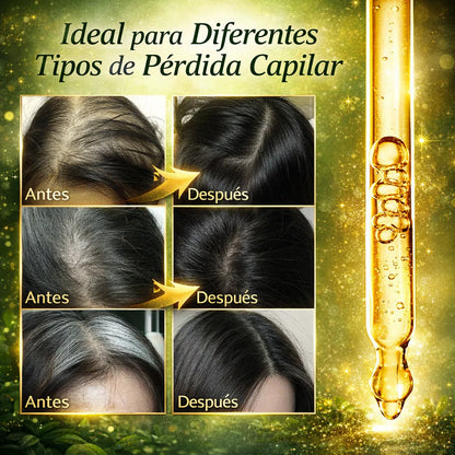 SHAMPOO DE BATANA 300 ML + 1 ACEITE DE BATANA GRATIS - ORIGINAL